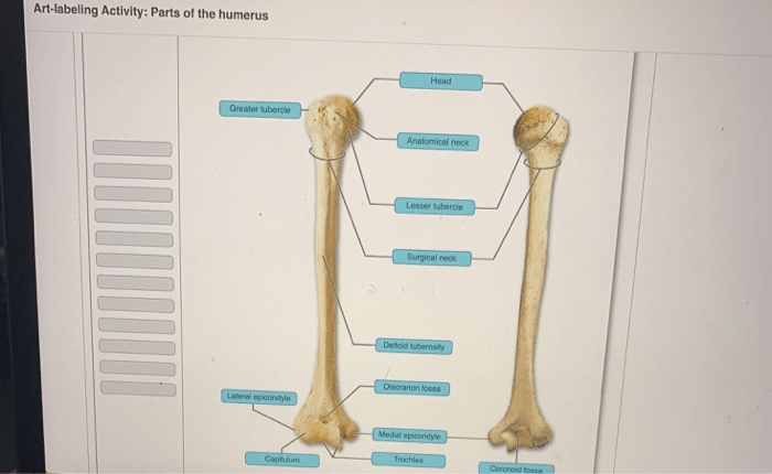 Section cross spinal cord dura mater anatomy meninges vertebrae biology google humor slide search